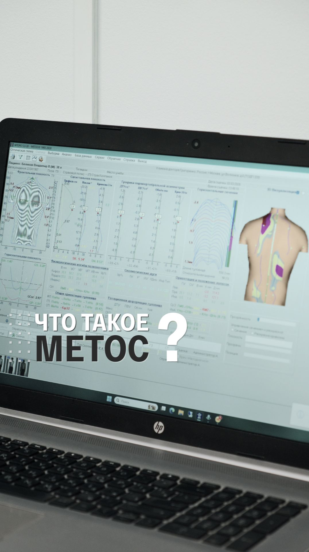 Компьютерная диагностика МЕТОС | Клиника доктора Григоренко
