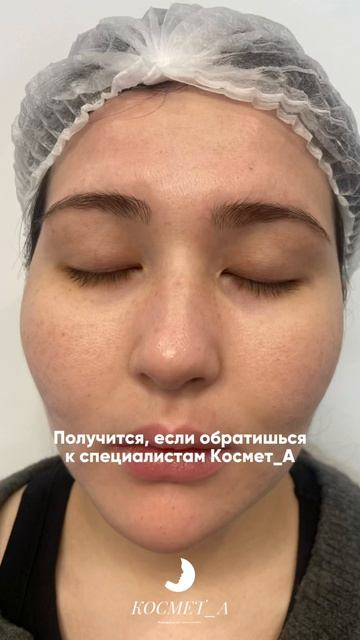 Не просто лечим акне — ведём до результата!