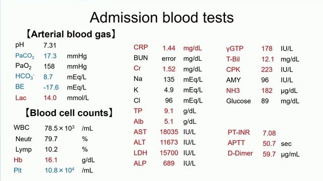 Acute Liver Failure Julia Wendon ISICEM 45