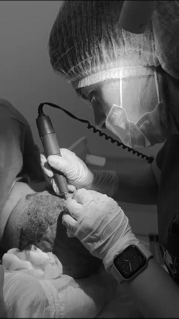 Рабочие будни в Venus Estetika - Процесс пересадки волос