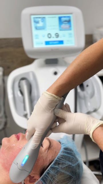 СМАС - лифтинг на аппарате Ультраформер