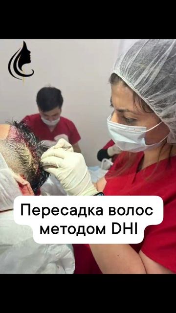 Пересадка волос методом DHI