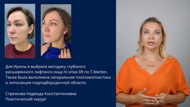 Подготовка к хирургическому омоложению лица