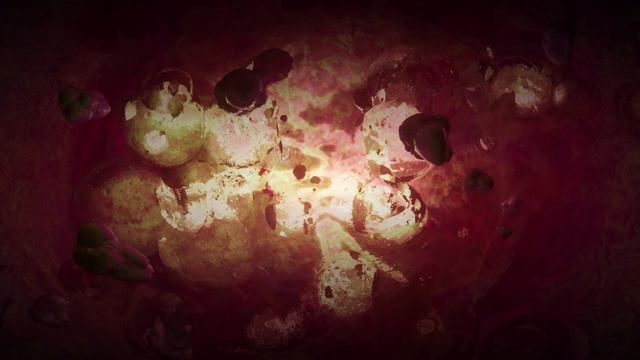 LS_12_Trainwreck_part_03