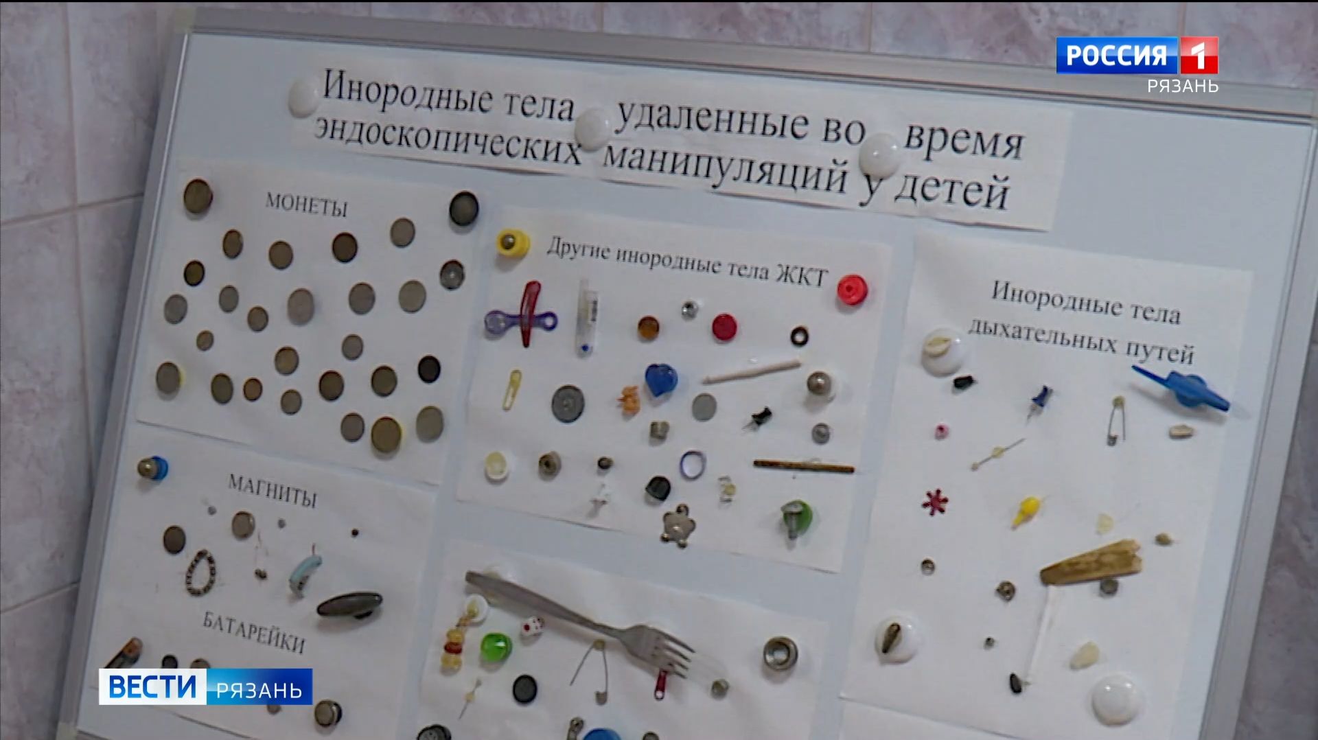 Батарейки и монеты: что проглатывают дети и чем это грозит