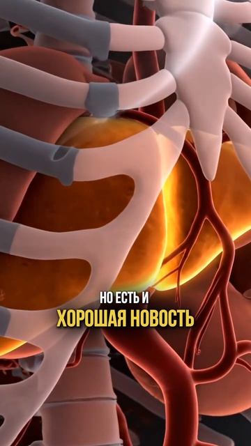 Ваши лишние килограммы — это не жир