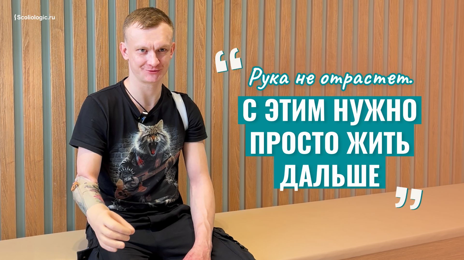 «Рука не отрастет. С этим нужно просто жить дальше»