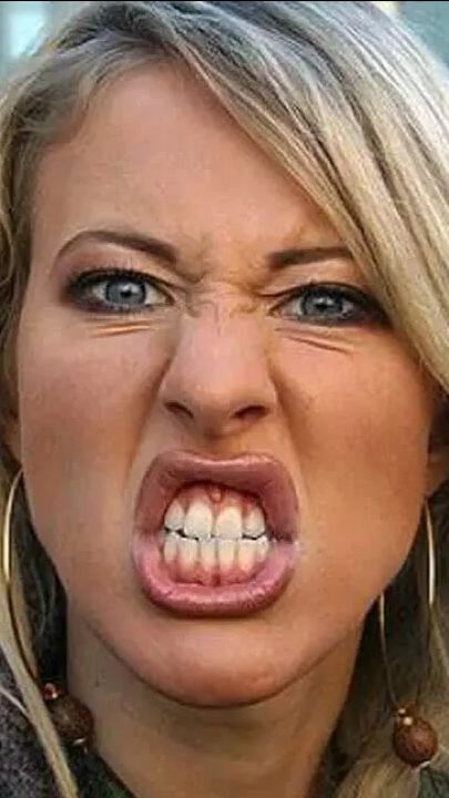 Собчак бездоказательно испортила воздух и облажалась 🐎