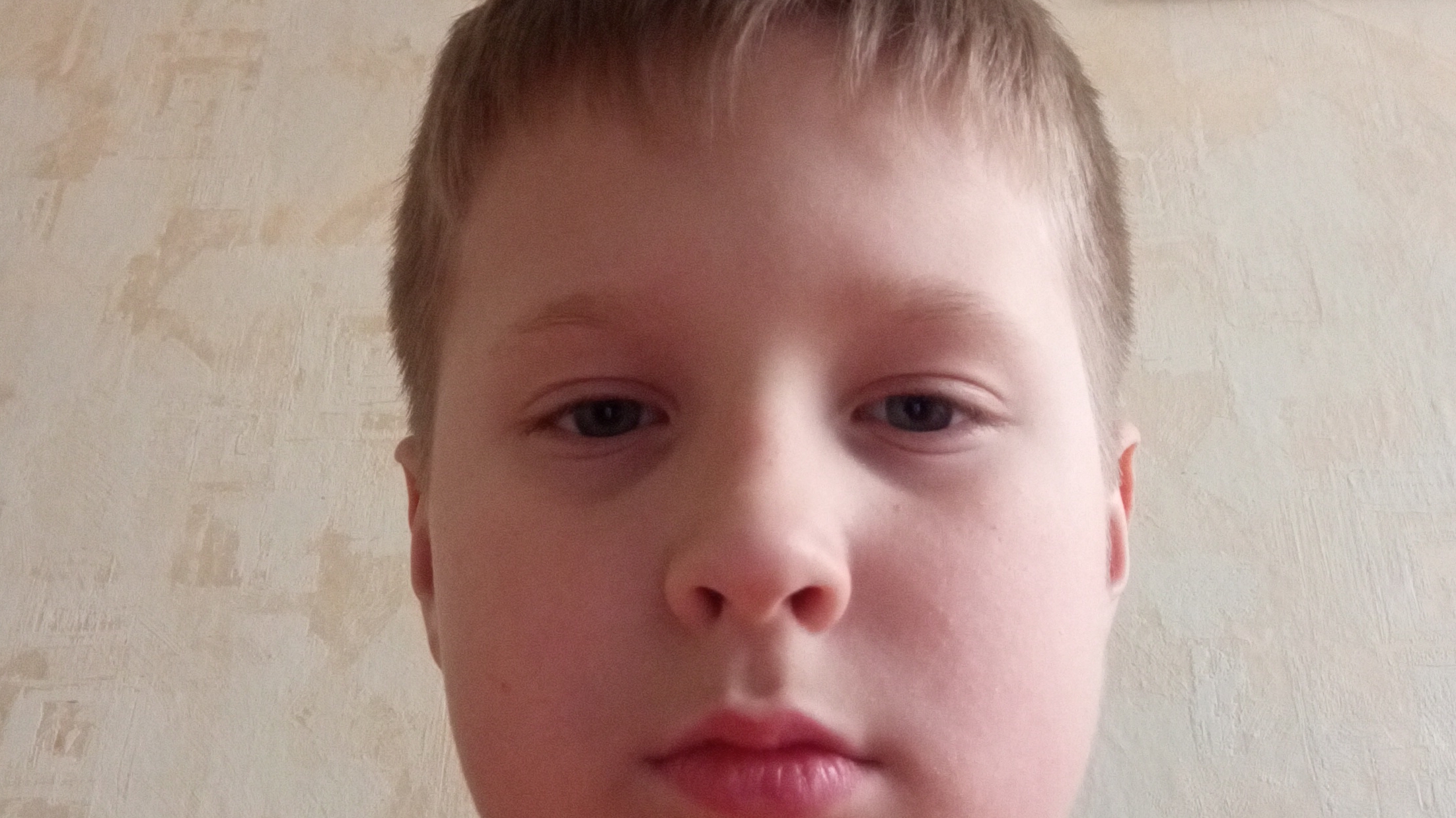 спалил лицо