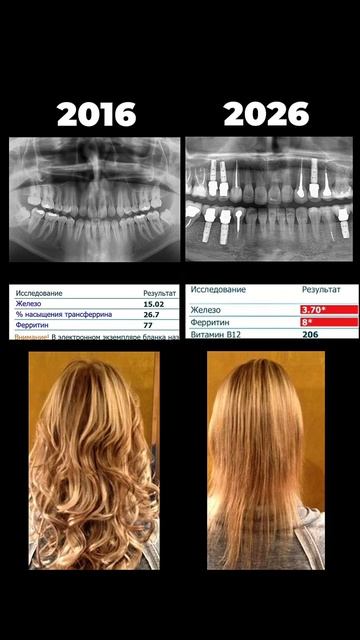 шутки шутками а рассыпаться раньше времени не хочется. Если организм начал сбоить ждем в НЕБОЛИТ.