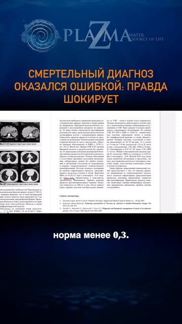 Опухоль или черви? КТ показало страшное