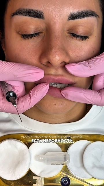 Безопасное растворение губ