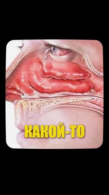 Аллергию нужно лечить  Александра Кузнецова  Кирилл Фомин подкаст