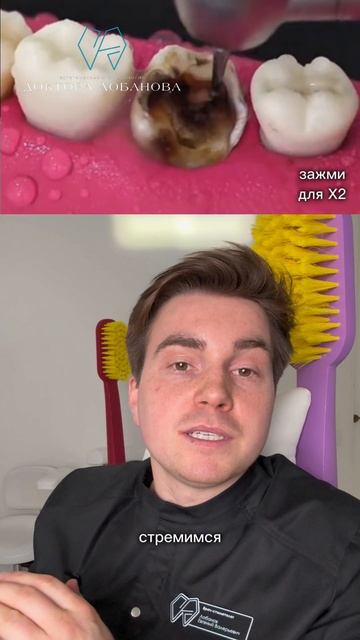 Почему 90 % зубов, которые можно было сохранить в других клиниках рекомендуют удалять?