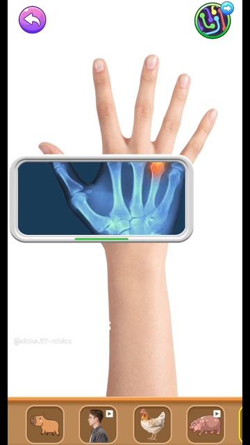 Рентген руки #игры #games #gaming #gameplay