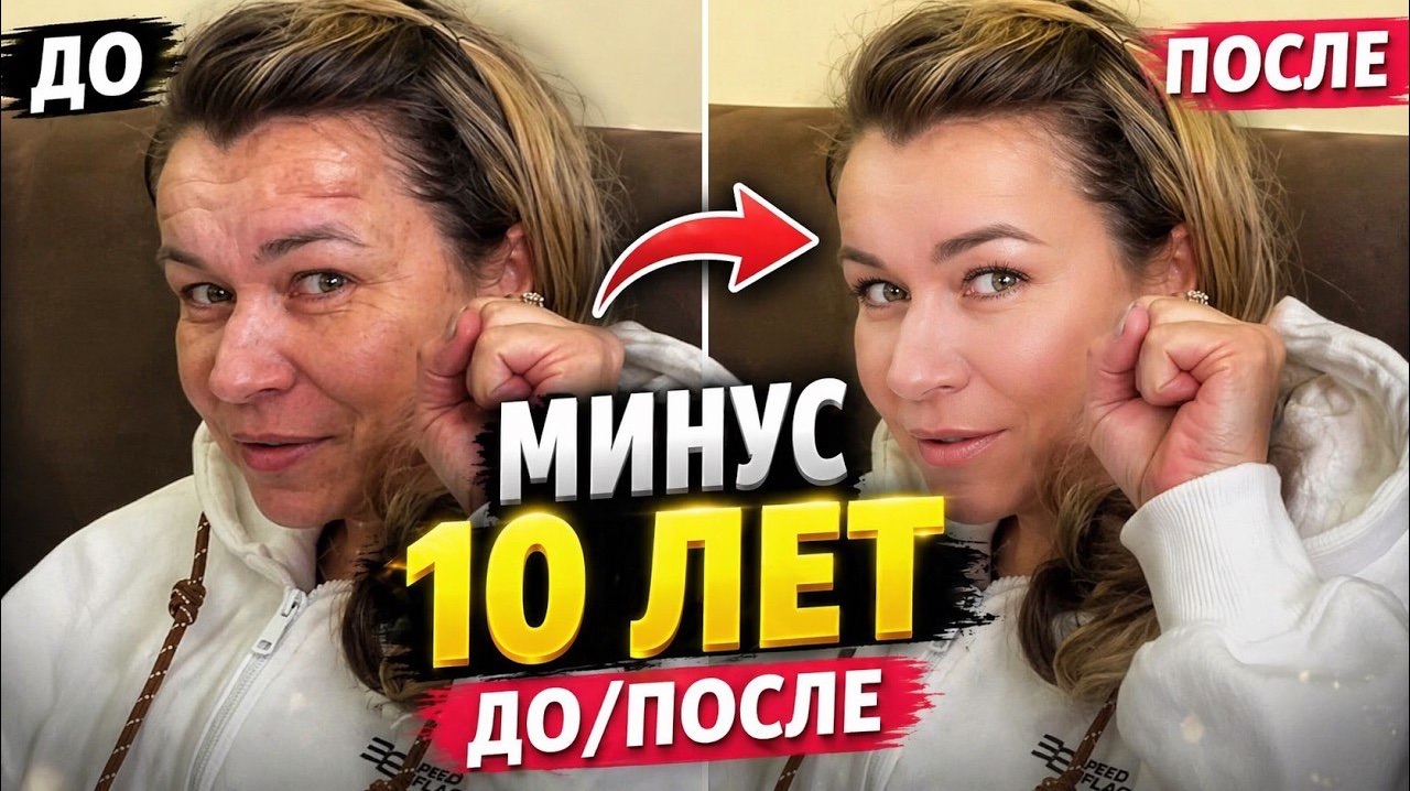 Иришку не узнать! Операция прошла успешно, теперь всё Чики Пики