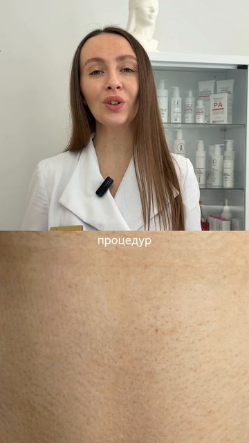 До / после — это не только про гладкость, но и про качество жизни.