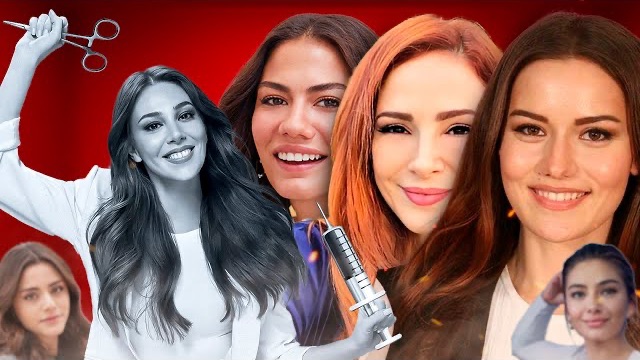 20 Турецких актрис, которые никогда не делали пластическую операцию