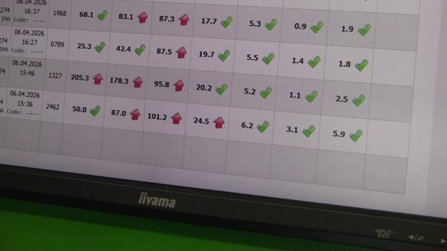 Состояние Форсунок при неисправном ТНВД. Hyundai Starex.