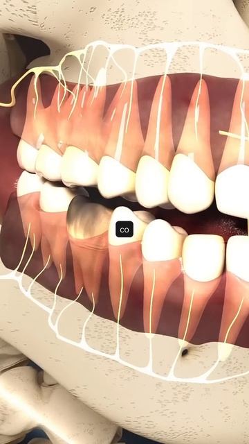 3 признака, что вам нужна коронка