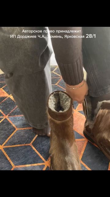 Подбор унтов при халюс вальгус