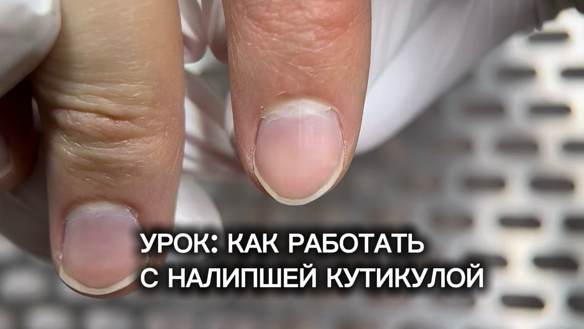 Как работать с налипшей кутикулой
