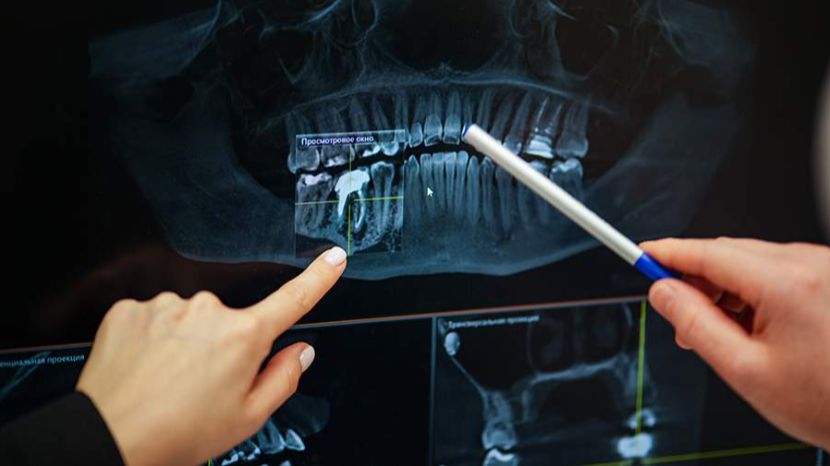 В Ростове-на-Дону мужчина чуть не задохнулся из-за запущенной болезни зубов