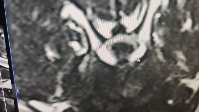 Рубин # Шереметьевский приют # собаки в дар