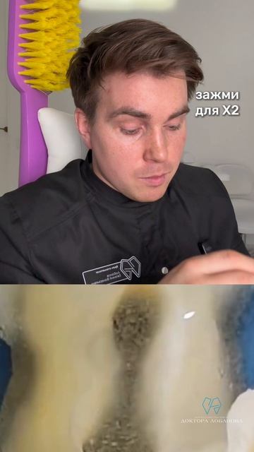 Что делать, если зуб сильно разрушен и растёт киста?