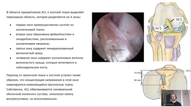 Колено 2 - внутренние структуры коленного сустава