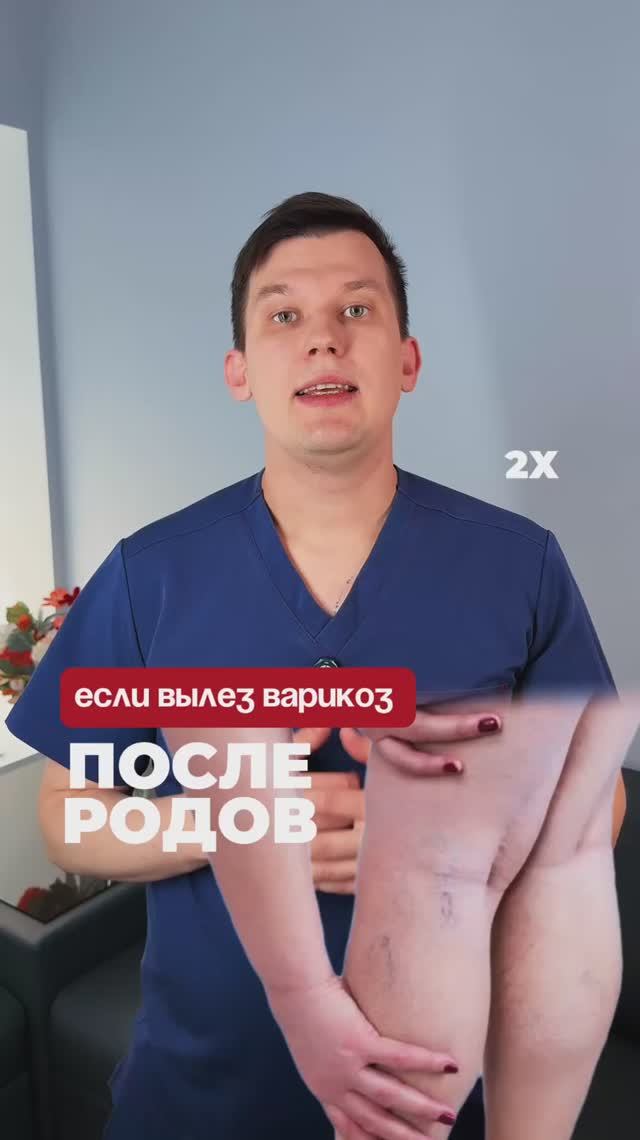 Варикоз пройдет после родов?