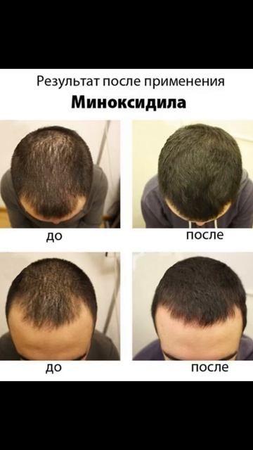 ♥️Beauty-Среда♥️