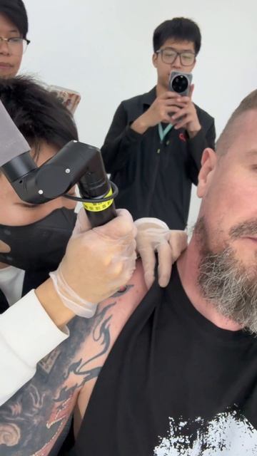 Лазер для удаления тату