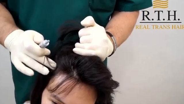 Как правильно наносить лечебные лосьоны на кожу головы?