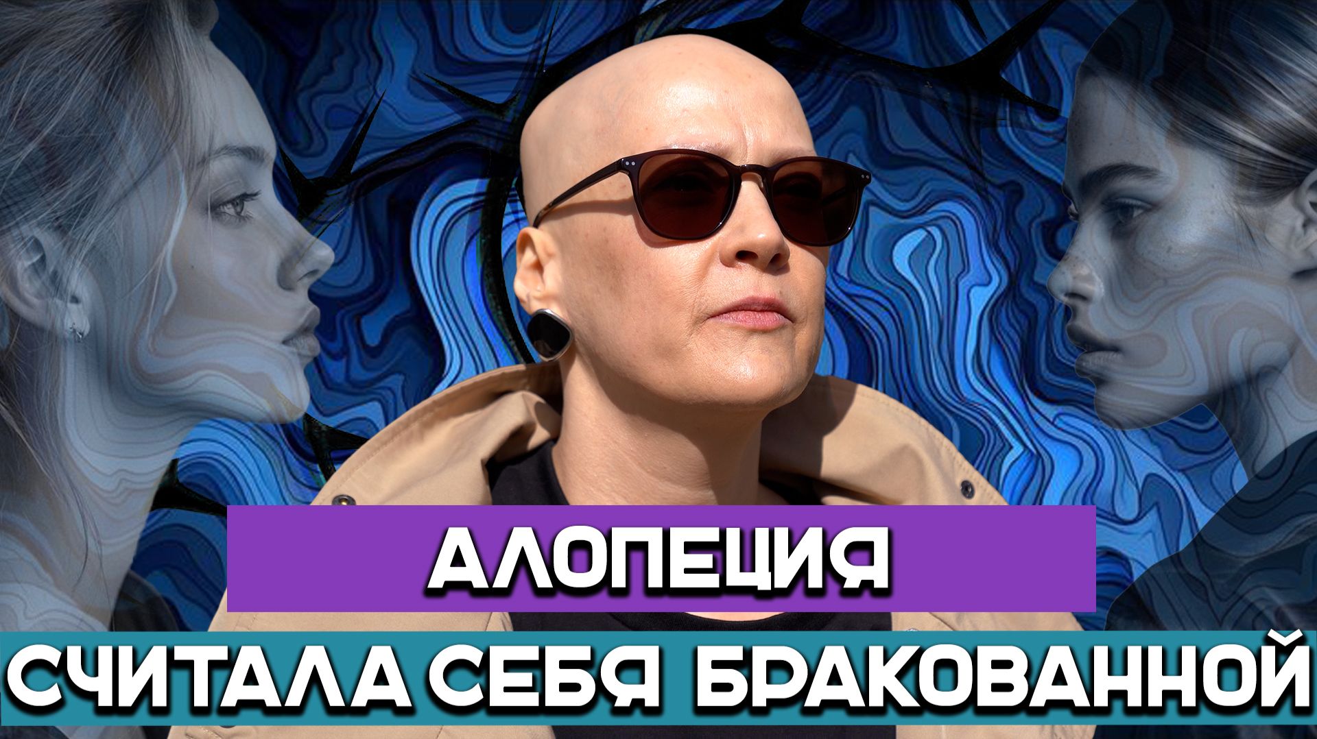 Считала себя бракованной. Как живет девушка с алопецией