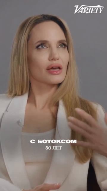 А вы за или против ботокса?💪