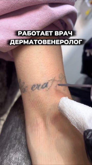 Удаление татуировок — это не мгновенное «стереть», (то что вы сейчас увидели в ролике), а постепенны