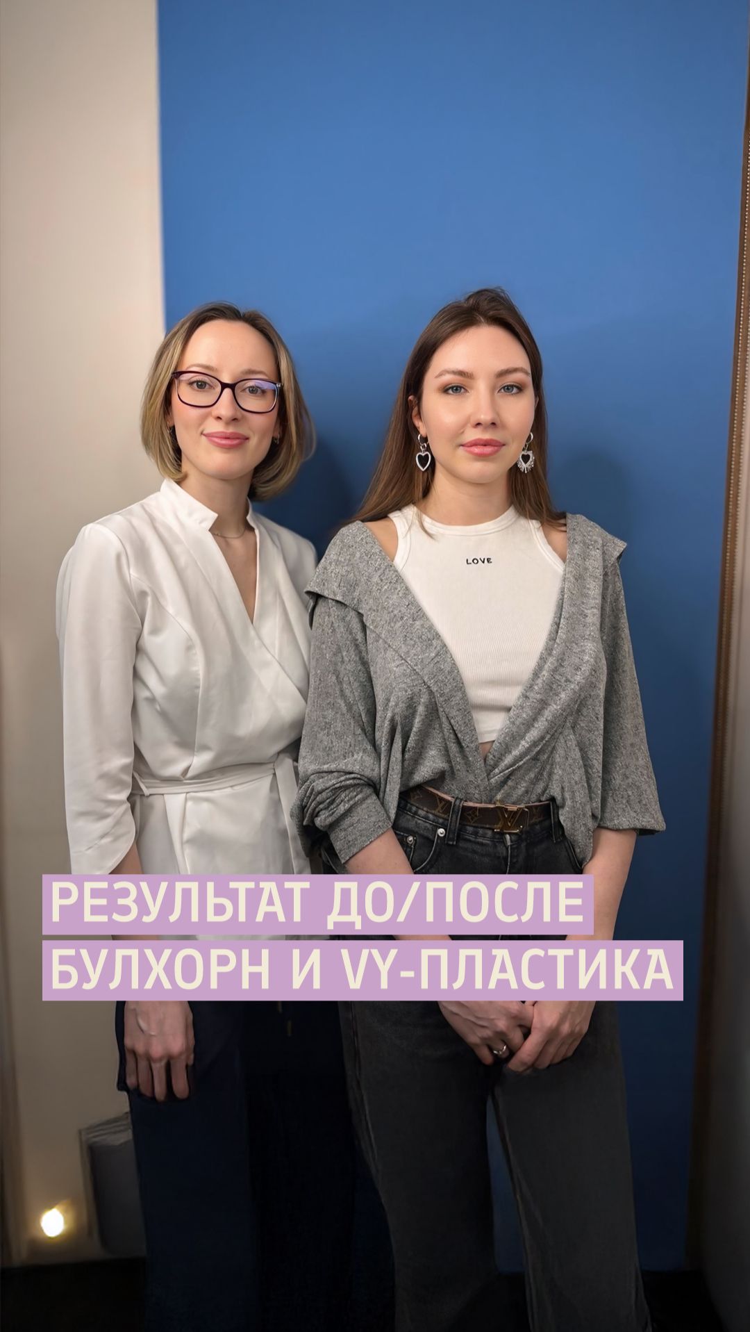 Увеличение губ: Булхорн и VY-пластика / Хейлопластика от пластического хирурга Грецковой Е.Е.