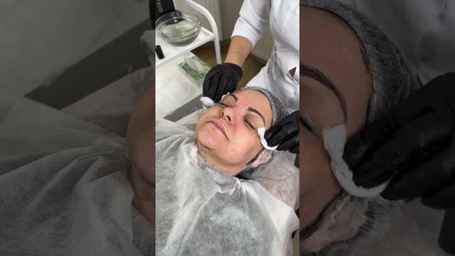 Максимальный Anti-Age эффект: V CARBON + Lift&Up