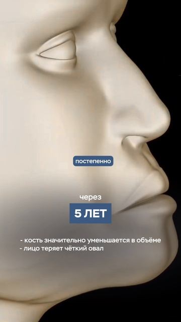 ЧТО ПРОИСХОДИТ ПОСЛЕ УСТАНОВКИ СЪЕМНОГО ПРОТЕЗА