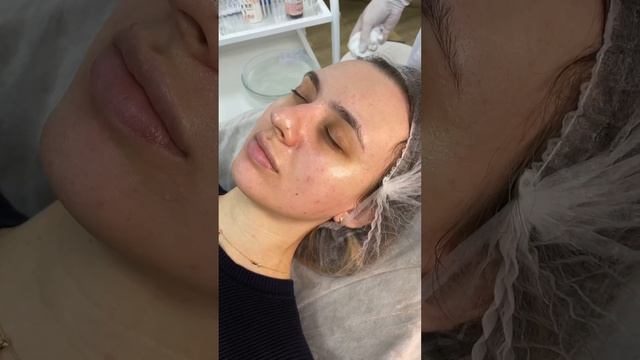 Fusion-терапия в косметологии 🧪