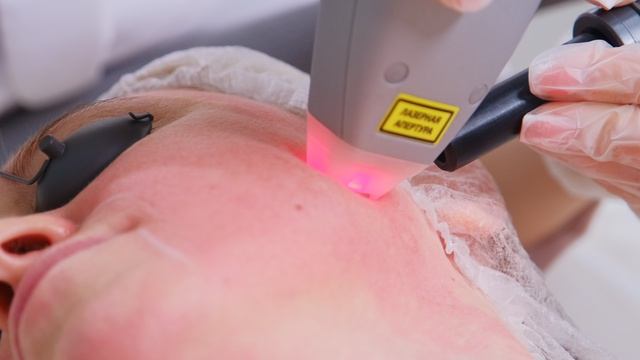 Обзор фракционного лазера Ixtron Fractional (Икстрон Фрэкшенал) от компании Мелситек