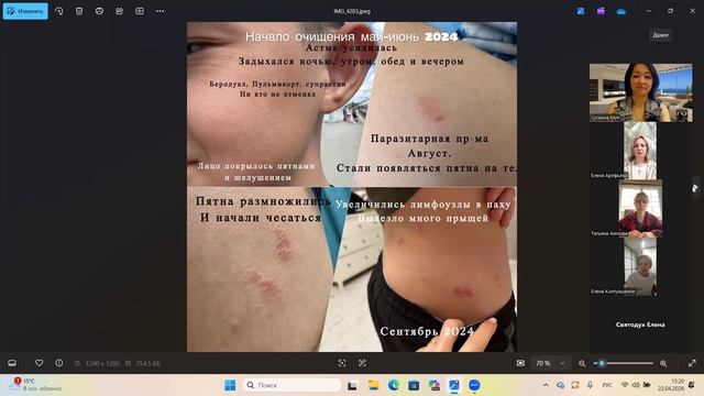 Здоровая среда. Аллергии, поллиноз, панические атаки