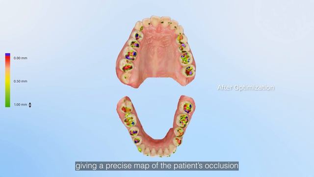 Introducing Aoralscan Elf — Small footprint. Big Impact