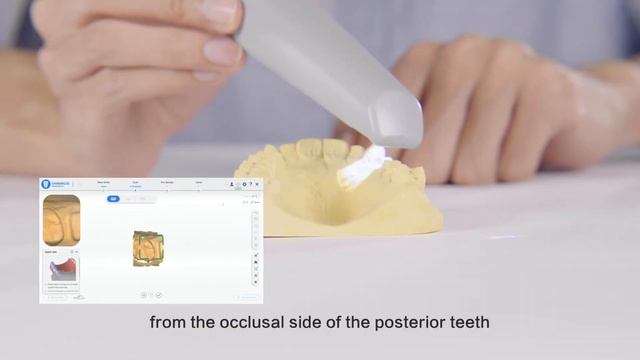 Aoralscan 3 — Scan Skills