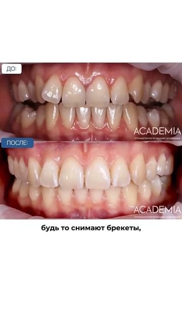 Ждём вас на приеме: 7 495 198-10-00 стоматологмосква стоматолог лечениезубов