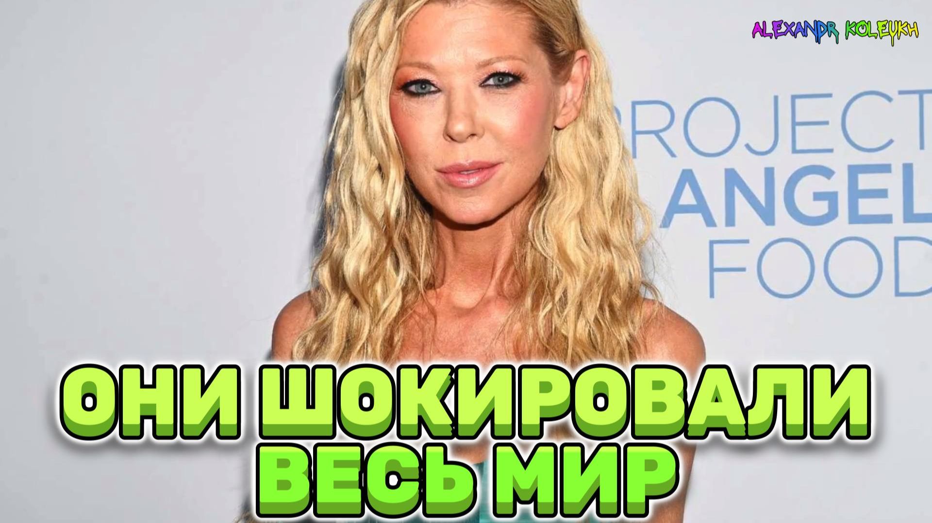 Неудачи знаменитостей в пластической хирургии