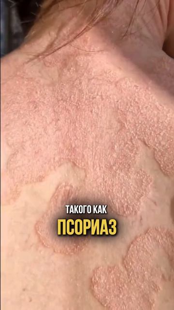 Ставим диагноз по ногтям