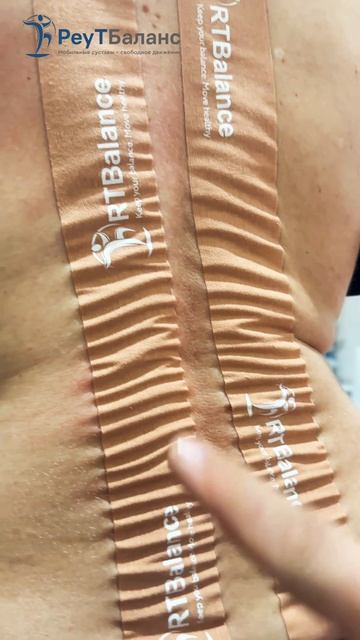 Тейпирование при сколиозе