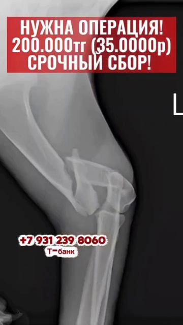 Спасите Жизнь. 🆘 ПОМОГИТЕ СДЕЛАТЬ ОПЕРАЦИЮ!
🚨 ДРУЗЬЯ, ОПЕРАЦИЮ НАДО БЫЛО СДЕЛАТЬ ЕЩЁ ВЧЕРА!!!